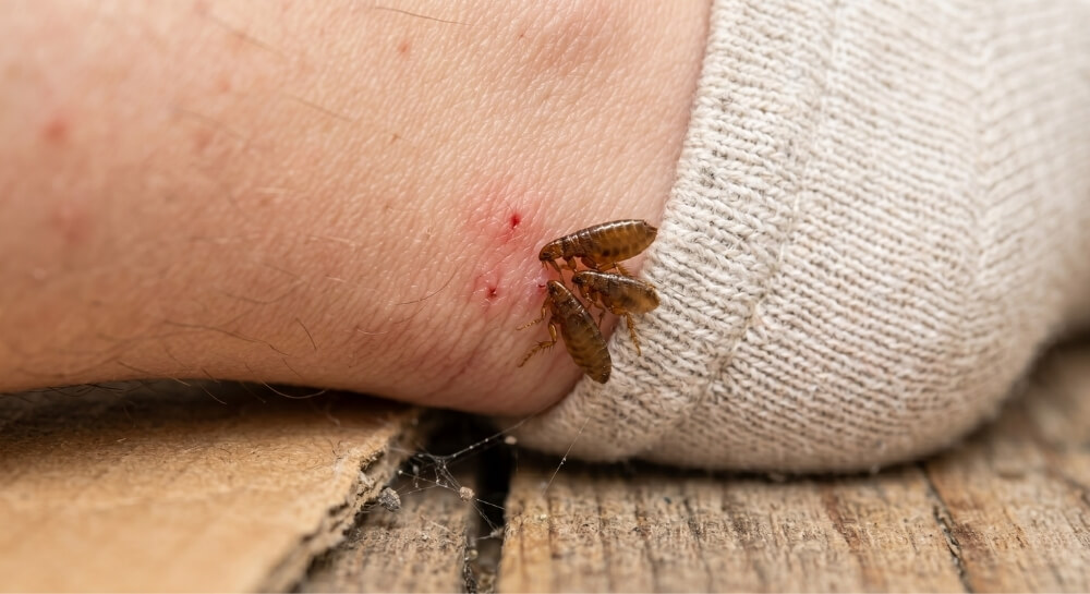 pchły ludzkie na nodze