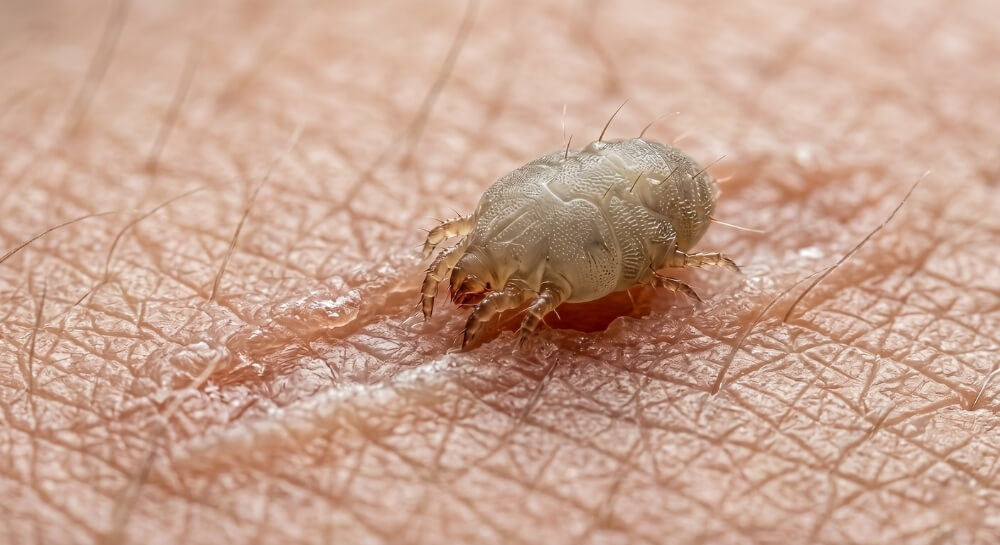 Robaki w domu – zdjęcia i nazwy szkodników skórnych